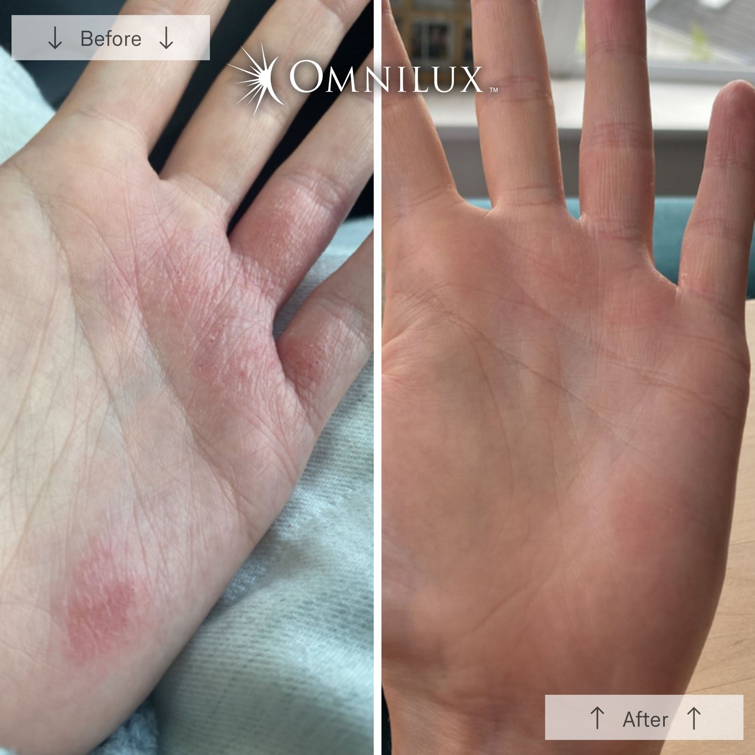 Omnilux Contour Glove