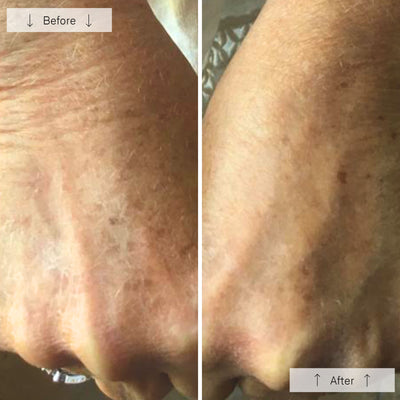 Omnilux Contour Glove