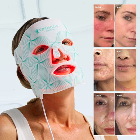 Inside the Omnilux Contour Face Clinical Study: What Research Reveals About LED Light Therapy for Wrinkles